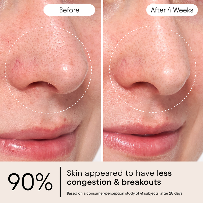 Alpyn Beauty-Clarifying Facial Oil With Retinol & Pink Algae-Skincare-FaceOil4_bbacb191-120a-412d-9d38-53d32db75e6b-The Detox Market |