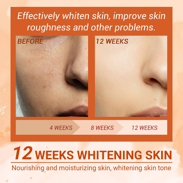 EELHOE Vitamin C Brightening Spray Skin Moisturizing And Fading Spray EELHOE COSMETICS