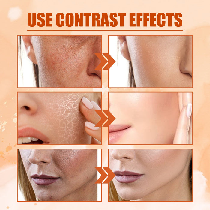 EELHOE Vitamin C Brightening Spray Skin Moisturizing And Fading Spray EELHOE COSMETICS