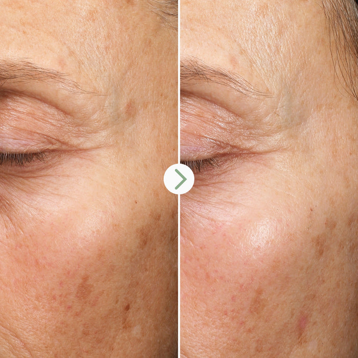 Pai Skincare-Fade Forward Dark Spot Serum-Skincare-5060139728379_5_91c69ade-79ec-488a-a4b4-145434a75eb8-The Detox Market |