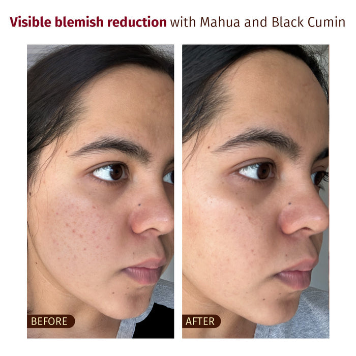 Befor and After Result -Gentle Cleansing Splash
