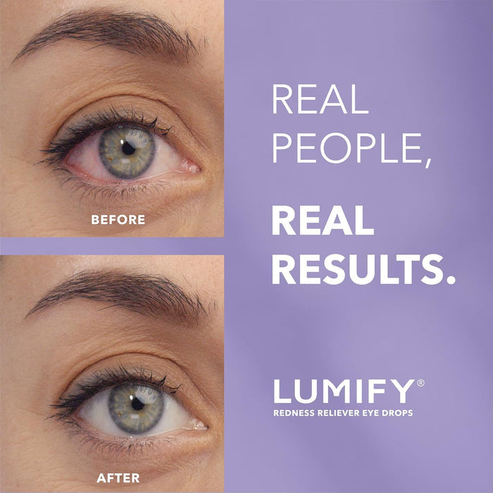 LUMIFY® Redness Reliever Eye Drops