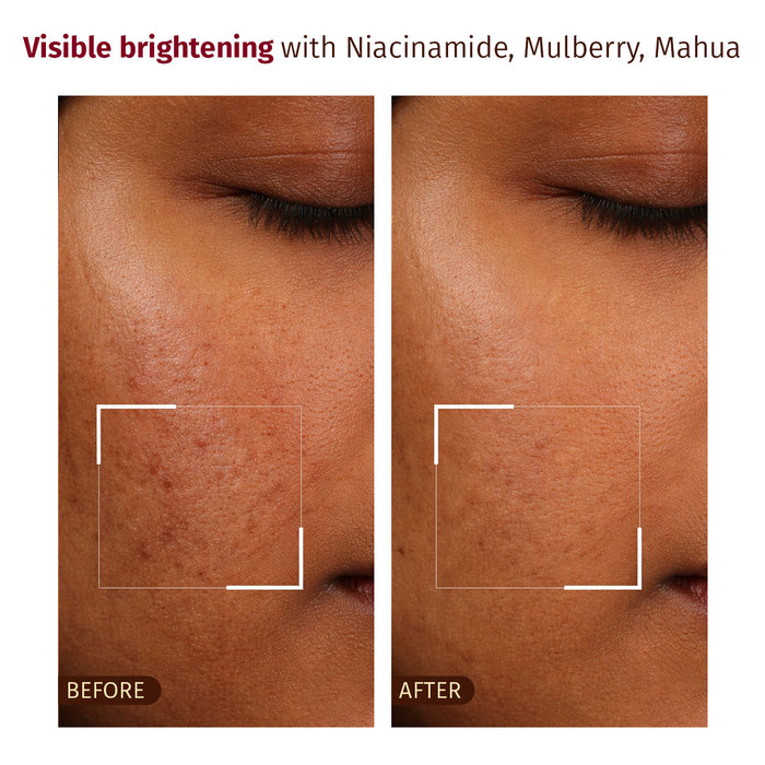 Befor and After Result -Luminous Cloud Cream