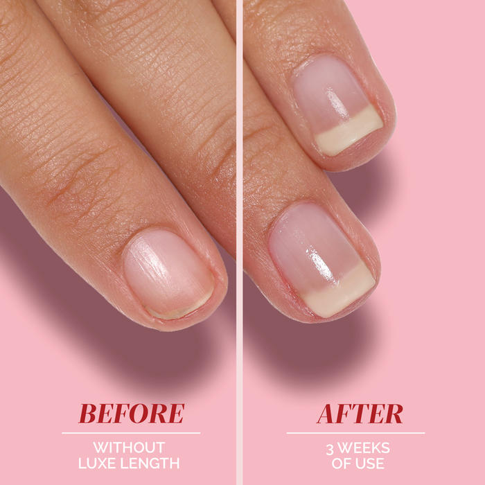 Side-by-side close-up of a fingernail before and after three weeks using LONDONTOWN Luxe Length Nail Gloss, highlighting longer nails, enhanced appearance, and a healthy shine.