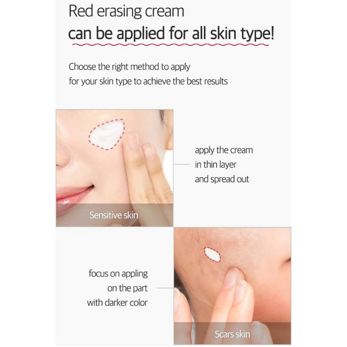 MEDICUBE RED ERASING CREAM (100ML)