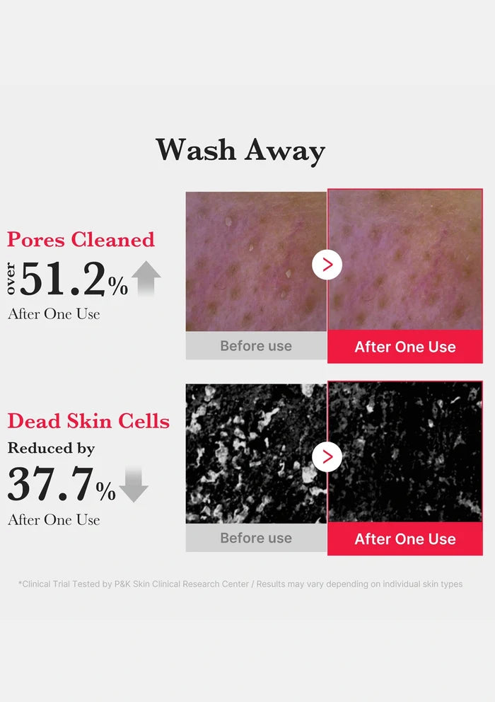 Before and after effects of a skincare product on skin pores and dead skin cells with text indicating percentage reductions.