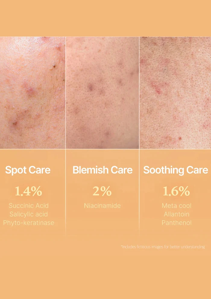 Skincare product comparison chart with different care types on skin texture background