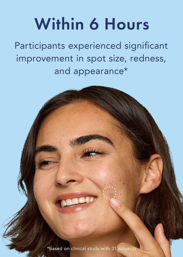 Rael Miracle Patch Advanced Strength Retinol Spot Cover Pimple Patches 24 patches