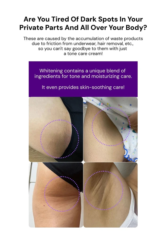 Advertisement for a skin whitening product with images of dark spots on skin and text about product benefits.